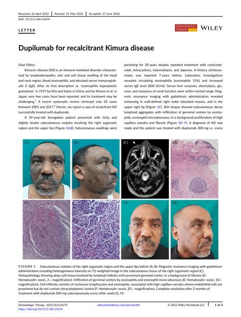 Two cases of Dupilumab responsive Kimura disease.