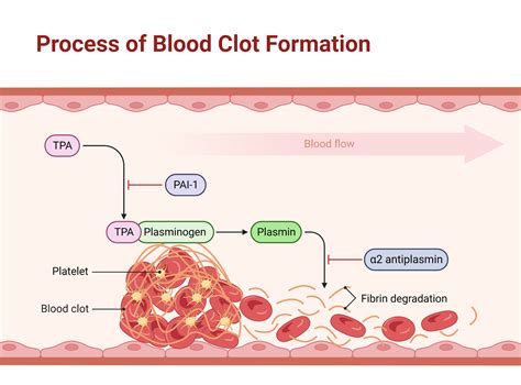 What Causes Blood Clot To Move